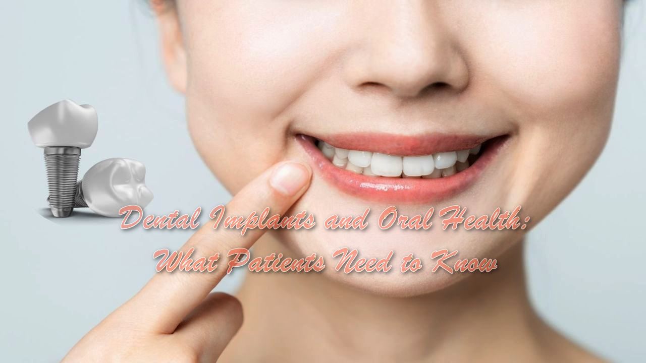 Dental Implants and Oral Health: What Patients Need to Know
