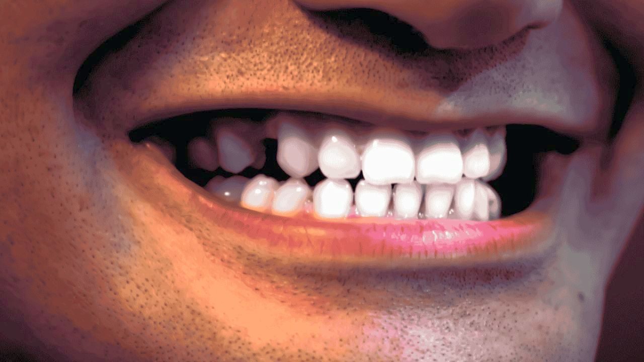 Why Missing Teeth Can Harm Oral Health Over Time